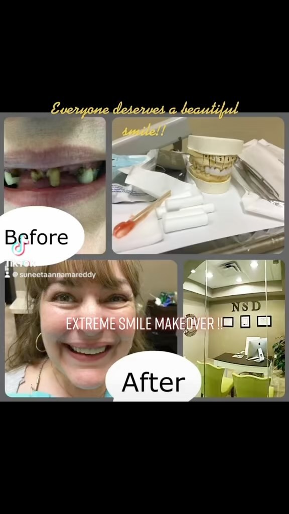 Tooth-loss restoration — Natural Smiles Dentistry, Chandler / Sun Lakes AZ